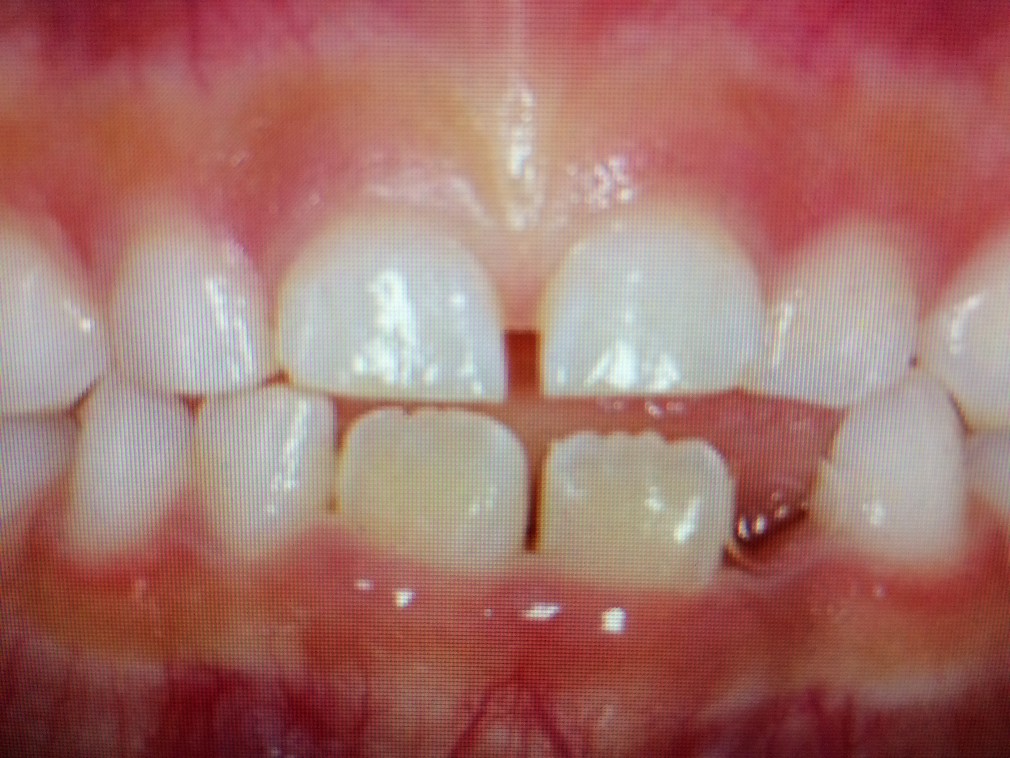 じんの歯科こども歯科小児の歯の色について Information じんの歯科 こども歯科 最新情報